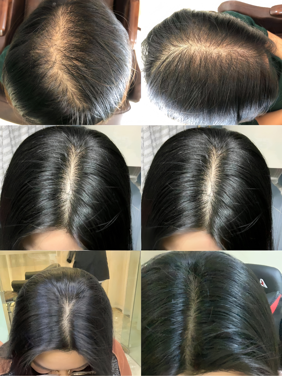 肖女士4个月与8个月护理记录对比图